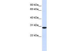 WB Suggested Anti-RPA4 Antibody Titration: 0. (RPA4 anticorps  (C-Term))