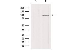 Western blot analysis of extracts from 293, using TF3C3 Antibody. (GTF3C3 anticorps)