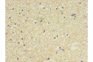 Immunohistochemistry of paraffin-embedded human brain tissue using ABIN7148084 at dilution of 1:100