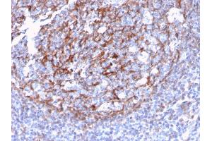 Formalin-fixed, paraffin-embedded human Tonsil Dendritic stained with CD21 / CR2 Recombinant Rabbit Monoclonal Antibody (CR2/3124R).