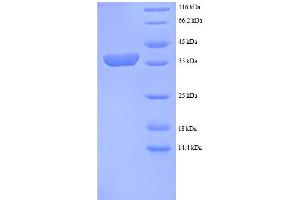 SDS-PAGE (SDS) image for HLA Class I Histocompatibility Antigen, alpha Chain G (HLAG) (AA 25-337), (partial) protein (His tag) (ABIN5712205)