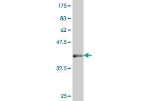 Western Blot detection against Immunogen (37. (HHEX anticorps  (AA 133-237))