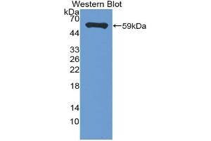 Detection of Recombinant MS4A1, Mouse using Polyclonal Antibody to Membrane Spanning 4 Domains Subfamily A, Member 1 (CD20) (CD20 anticorps  (AA 6-251))