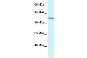 WB Suggested Anti-PKN2 Antibody Titration: 1. (PKN2 anticorps  (C-Term))