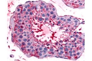 Anti-BEST2 / Bestrophin-2 antibody IHC of human testis. (Bestrophin 2 anticorps  (Internal Region))