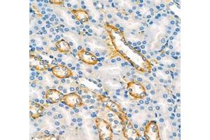 Immunohistochemistry of paraffin embedded rat kidney using ATP1HC1 (ABIN7073160) at dilution of 1:500 (400x lens)