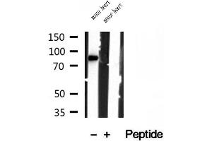 Western blot analysis of extracts of mouse heart tissue, using YME1L1 antibody. (YME1L1 anticorps  (C-Term))