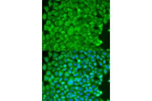 Immunofluorescence analysis of HeLa cells using SGCE antibody (ABIN5973070). (SGCE anticorps)