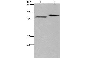 Western Blot analysis of Human fetal brain and Mouse brain tissue using EGR4 Polyclonal Antibody at dilution of 1:400 (EGR4 anticorps)