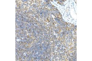 Immunohistochemistry of paraffin-embedded rat brain using LGR5/GPR49 Rabbit pAb  at dilution of 1:300 (40x lens).