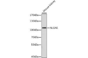 Western blot analysis of extracts of mouse kidney, using NLGN1 antibody (ABIN7268873) at 1:1000 dilution.