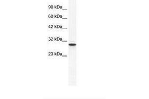Image no. 1 for anti-Annexin A5 (ANXA5) (AA 71-120) antibody (ABIN202233) (Annexin V anticorps  (AA 71-120))