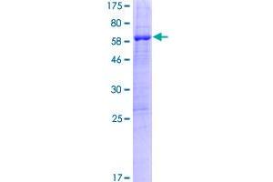 Image no. 1 for Peptidylprolyl Isomerase (Cyclophilin)-Like 6 (PPIL6) (AA 1-311) protein (GST tag) (ABIN1315903)