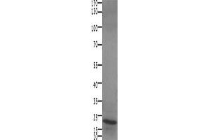 Gel: 10+12 % SDS-PAGE, Lysate: 30 μg, Lane: Human liver cancer tissue, Primary antibody: ABIN7192693(STMN2/STMN3/STMN4 Antibody) at dilution 1/450, Secondary antibody: Goat anti rabbit IgG at 1/8000 dilution, Exposure time: 1 minute (STMN2/STMN3/STMN4 anticorps)