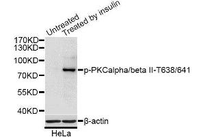 Western blot analysis of extracts of HeLa cells, using Phospho-PRKCB-T641 antibody (ABIN2987563) at 1/1000 dilution. (PKC beta anticorps  (pThr641))