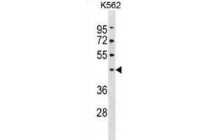 Western Blotting (WB) image for anti-Pellino E3 Ubiquitin Protein Ligase 1 (PELI1) antibody (ABIN3000532) (Pellino 1 anticorps)