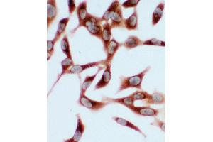 Anti-Hsc70 antibody, ICC ICC: HELA Cell