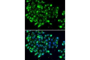 Immunofluorescence analysis of MCF-7 cells using NAT9 antibody (ABIN5974337). (NAT9 anticorps)