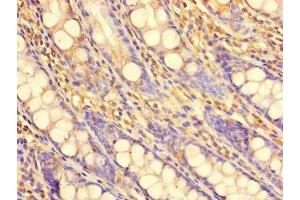 Immunohistochemistry of paraffin-embedded human colon tissue using ABIN7169137 at dilution of 1:100 (PDIK1L anticorps  (AA 1-341))