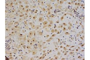 Formalin-fixed and paraffin embedded human pancreas labeled with Anti-IGF II/IGF2 Polyclonal Antibody, Unconjugated (ABIN723620), followed by conjugation to the secondary antibody and DAB staining (IGF2 anticorps  (AA 25-51))