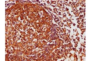 IHC image of ABIN7146858 diluted at 1:1000 and staining in paraffin-embedded human lymph node tissue performed on a Leica BondTM system. (Casein Kinase 1 delta anticorps  (Isoform delta))