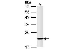 WB Image Sample (30 ug of whole cell lysate) A: A431 , 12% SDS PAGE antibody diluted at 1:1000 (BID anticorps)