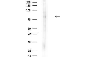 anti-Melanophilin (MLPH) (C-Term) antibody