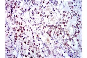Image no. 2 for anti-Cyclin-Dependent Kinase 2 (CDK2) (AA 197-295) antibody (ABIN1497393)