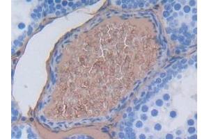 Detection of ALB in Mouse Testis Tissue using Polyclonal Antibody to Albumin (ALB)