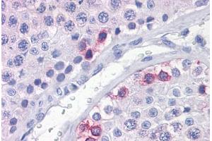 Human Testis: Formalin-Fixed, Paraffin-Embedded (FFPE)