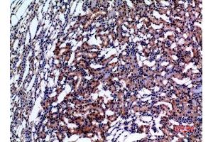 Immunohistochemistry (IHC) analysis of paraffin-embedded Rat Kidney, antibody was diluted at 1:100.