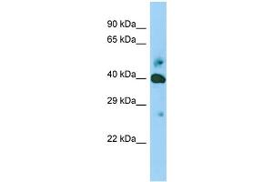 Host: Rabbit Target Name: SHF Sample Type: Jurkat Whole Cell lysates Antibody Dilution: 1. (SHF anticorps  (Middle Region))