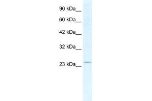 WB Suggested Anti-SOX14 Antibody Titration:  2. (SOX14 anticorps  (Middle Region))