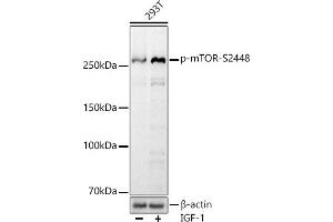 Western blot analysis of extracts of 293T cells, using Phospho-mTOR-S2448 antibody (ABIN7268435) at 1:1000 dilution.