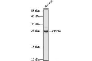 Western blot analysis of extracts of Rat eye using CPLX4 Polyclonal Antibody at dilution of 1:3000. (Complexin 4 anticorps)