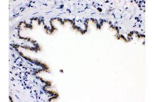 IHC testing of FFPE rat lung with ARSA antibody. (Arylsulfatase A anticorps)