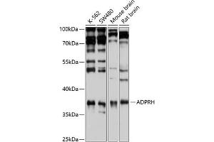 Western blot analysis of extracts of various cell lines, using ADPRH antibody (ABIN6129880, ABIN6136587, ABIN6136588 and ABIN6221872) at 1:1000 dilution.