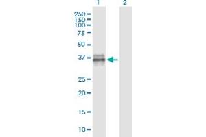 Western Blot analysis of IGFBP3 expression in transfected 293T cell line by IGFBP3 monoclonal antibody (M02), clone 2G6. (IGFBP3 anticorps  (AA 182-291))