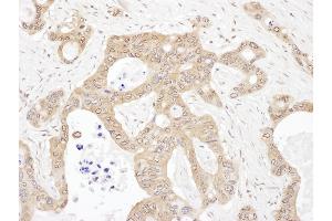 Immunohistochemistry (IHC) image for anti-Leucyl-tRNA Synthetase (LARS) (AA 250-300) antibody (ABIN7454577) (LARS anticorps  (AA 250-300))