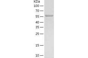 Western Blotting (WB) image for phosphoglycerate Dehydrogenase (PHGDH) (AA 1-533) protein (His-IF2DI Tag) (ABIN7124414)