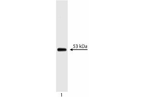 Western blot analysis of p53. (p53 anticorps  (AA 14-289))