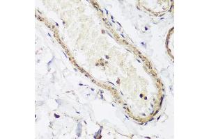 Immunohistochemistry of paraffin-embedded human colon using CAV3 antibody at dilution of 1:200 (40x lens). (Caveolin 3 anticorps)