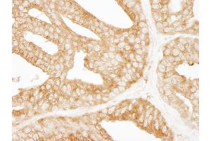 anti-Epidermal Growth Factor Receptor Pathway Substrate 15 (EPS15) (AA 575-625) antibody