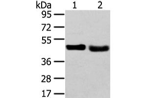 Western Blot analysis of 231 cell and Human fetal liver tissue using TRIB2 Polyclonal Antibody at dilution of 1/450 (TRIB2 anticorps)