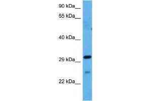Host:  Rabbit  Target Name:  GJB1  Sample Tissue:  Mouse Spleen  Antibody Dilution:  1ug/ml (GJB1 anticorps  (Middle Region))