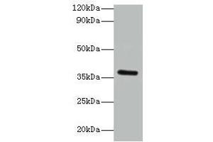 Western blot All lanes: BRCC3 antibody at 2 μg/mL + K562 whole cell lysate Secondary Goat polyclonal to rabbit IgG at 1/15000 dilution Predicted band size: 37, 34, 24, 29 kDa Observed band size: 37 kDa (BRCC3 anticorps  (AA 14-316))
