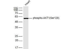 Mouse heart lysates probed with AKT1(Ser129) Polyclonal Antibody, Unconjugated  at 1:300 dilution and 4˚C overnight incubation. (AKT1 anticorps  (pSer129))