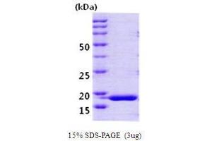Figure annotation denotes ug of protein loaded and % gel used. (PPIH Protein (AA 1-177))
