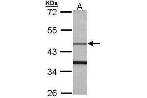 WB Image Sample (30 ug of whole cell lysate) A: Raji 10% SDS PAGE antibody diluted at 1:1000 (FBXO15 anticorps)