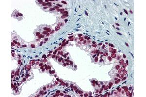 Anti-SP1 antibody IHC of human prostate. (SP1 anticorps  (AA 89-199))